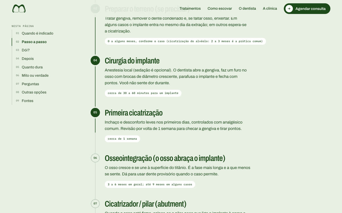 Ficha do implante unitário no site da Magistral, com o passo a passo numerado