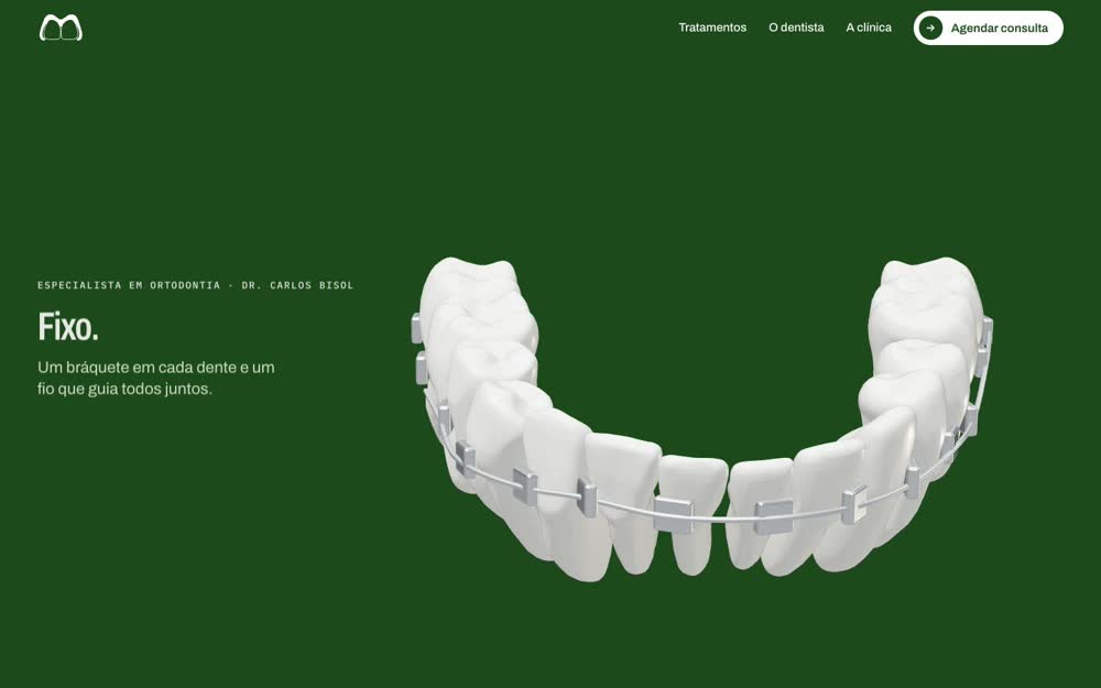 Um bráquete em cada dente e o fio que guia todos. Depois, o alinhador.